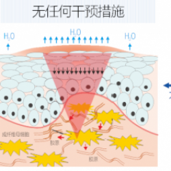 磕碰伤疤痕如何修复 施可复来助力